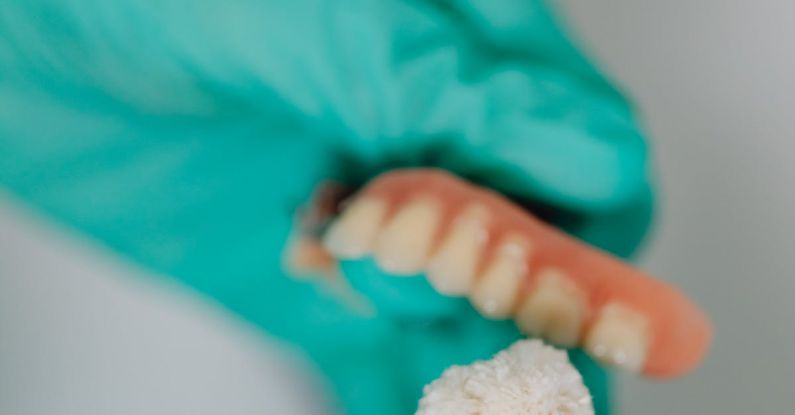 Medical Implants - Close-up of Dentist Polishing Teeth Implants